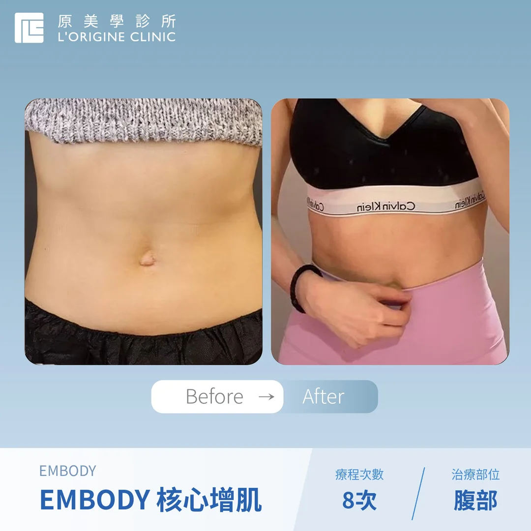 EMBODY 核心增肌 療程前後