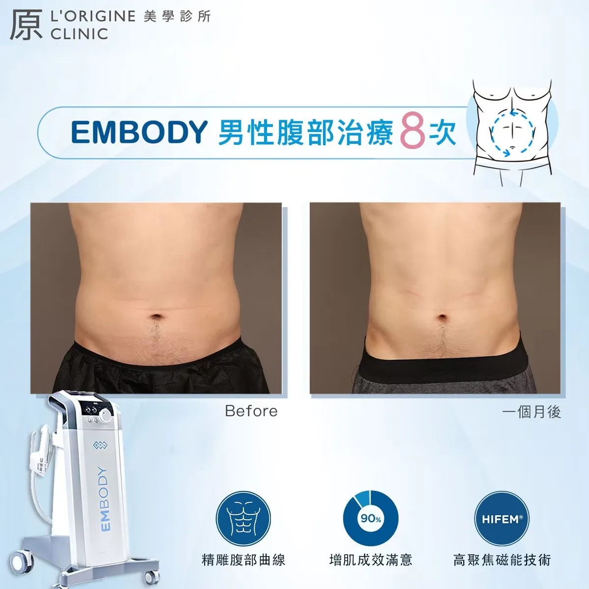 EMBODY 療程前後