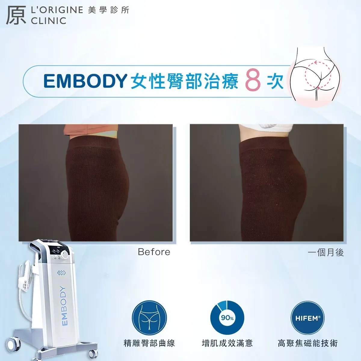 EMBODY 療程前後