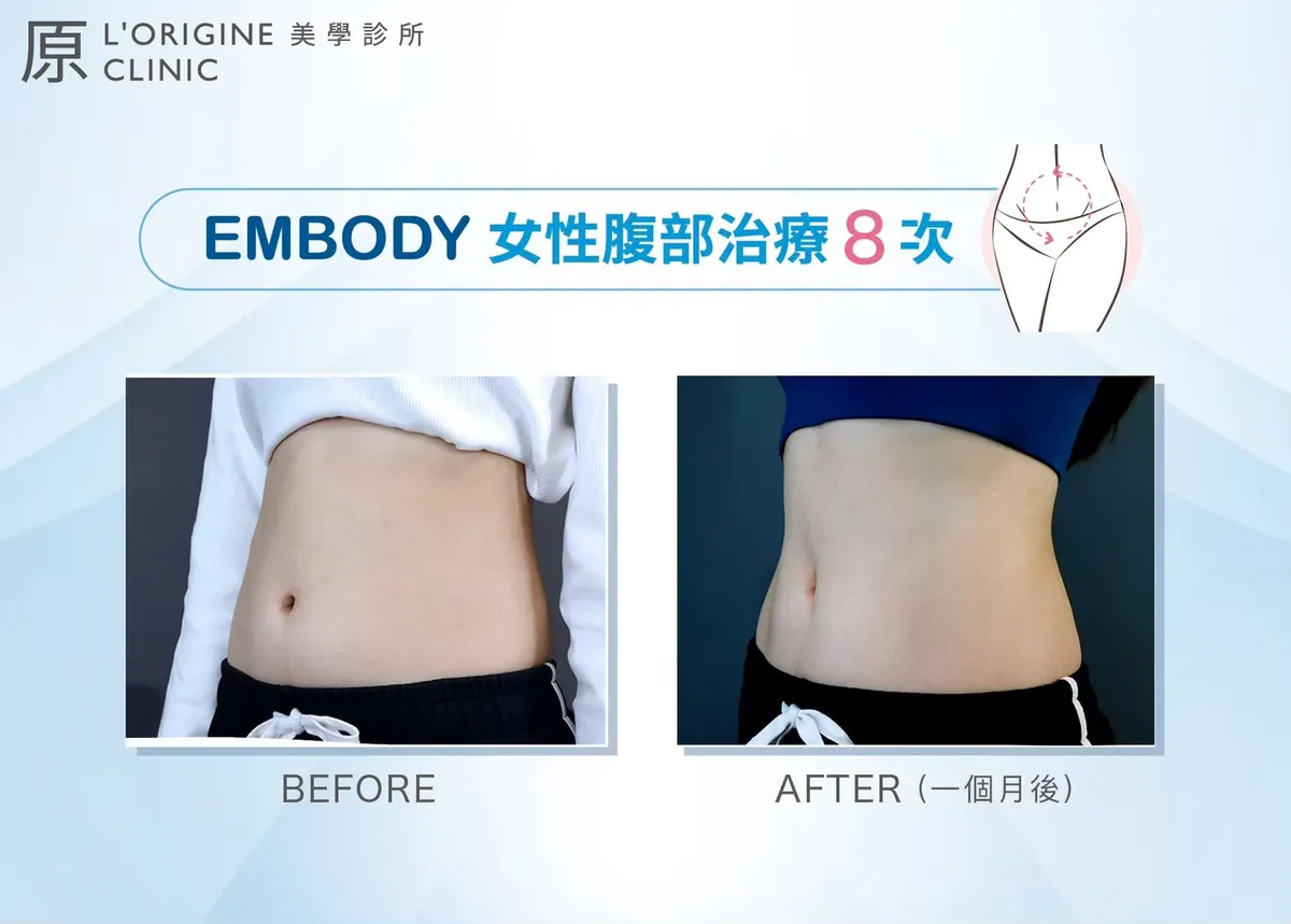 EMBODY 療程前後