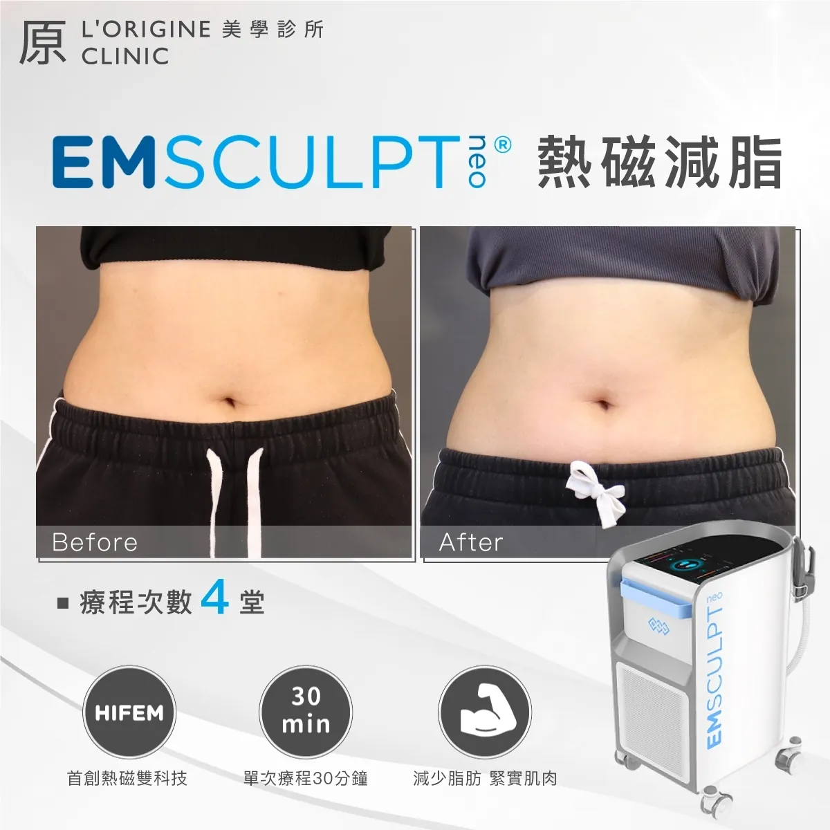 EMsculpt NEO 療程前後