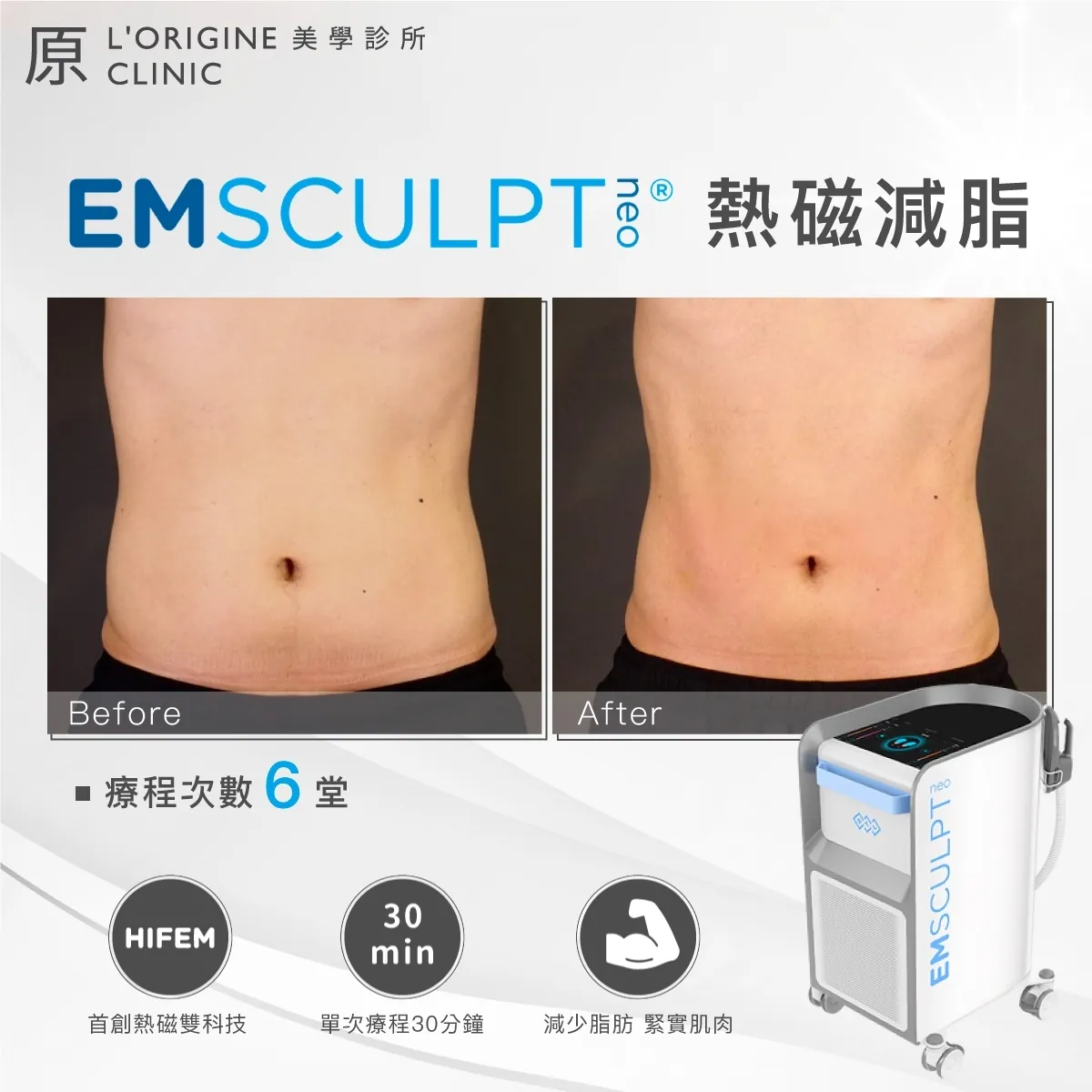 EMsculpt NEO 療程前後