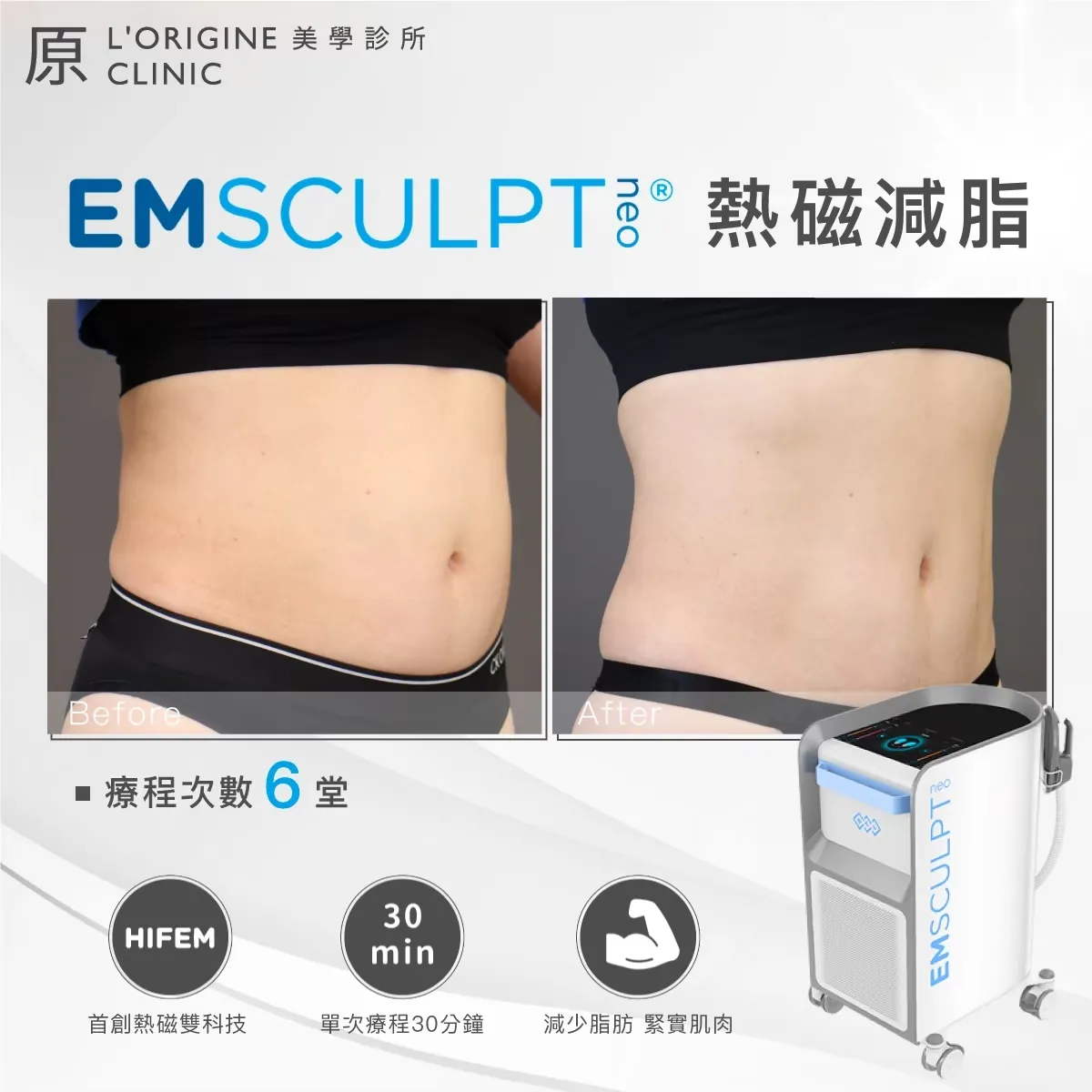 EMsculpt NEO 療程前後