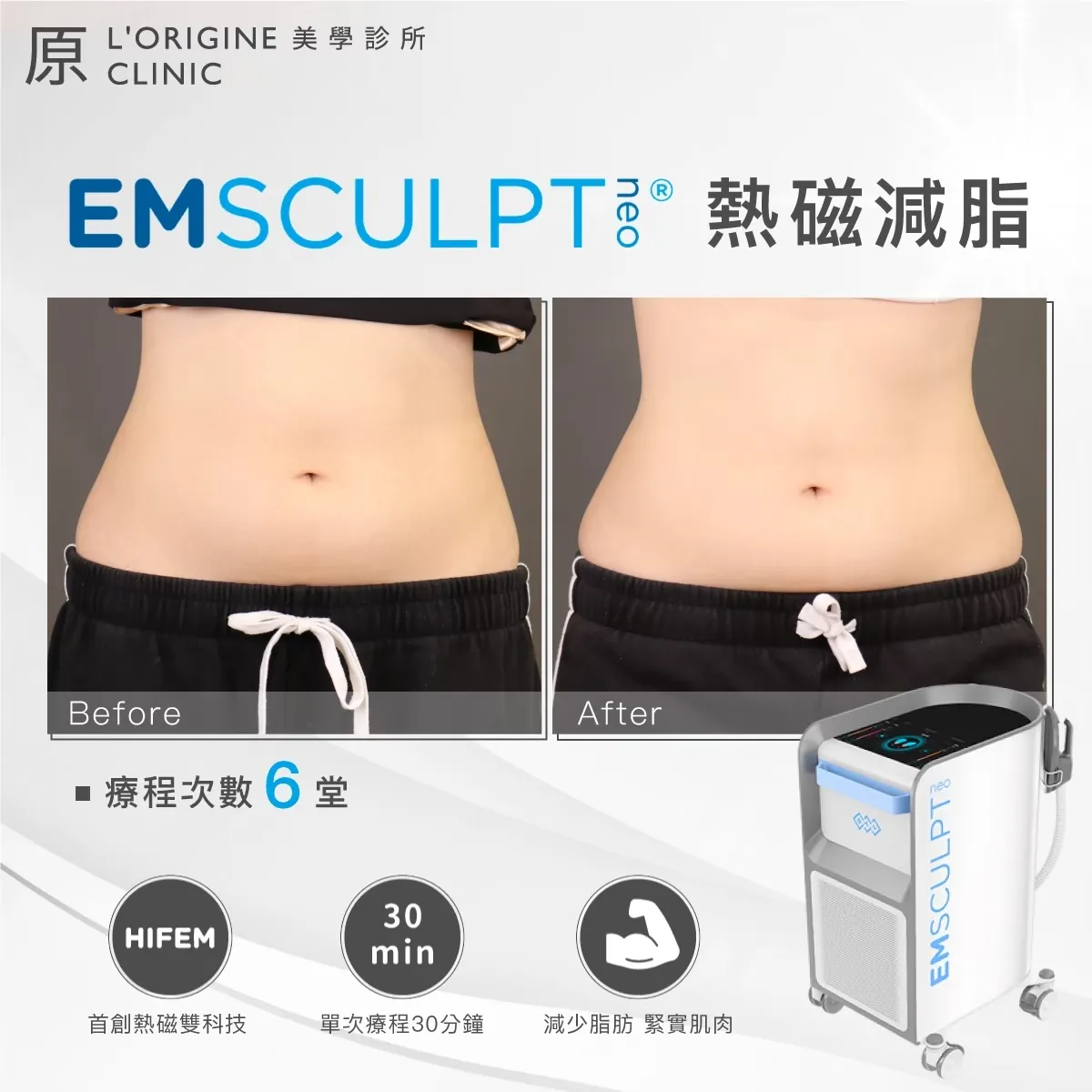 EMsculpt NEO 療程前後