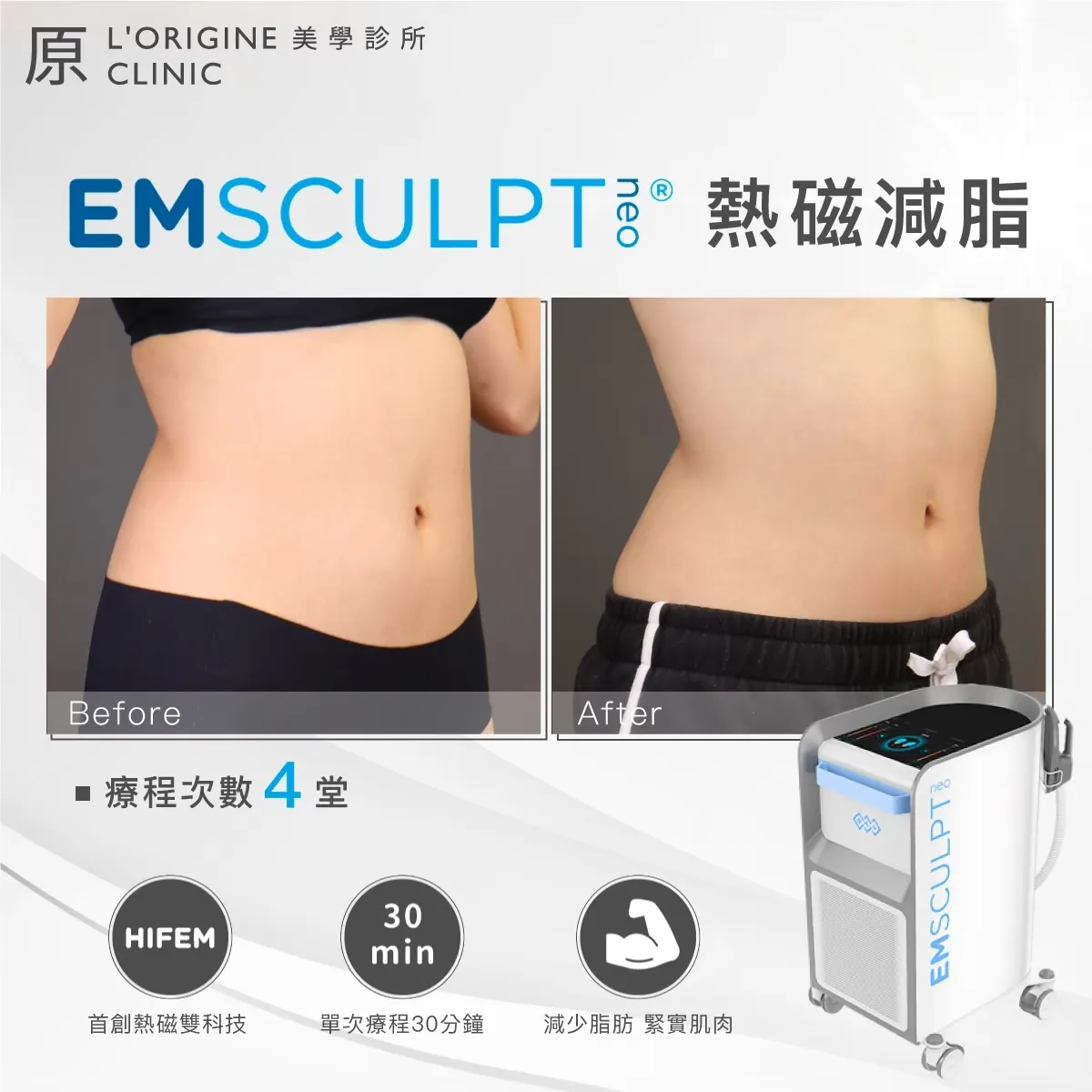 EMsculpt NEO 療程前後