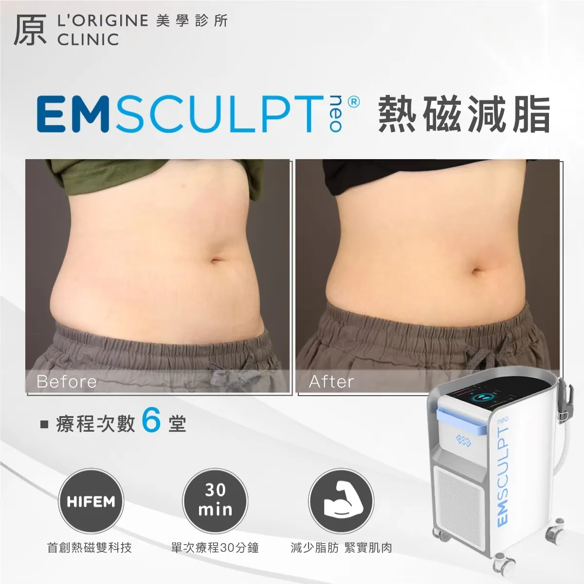 EMsculpt NEO 療程前後