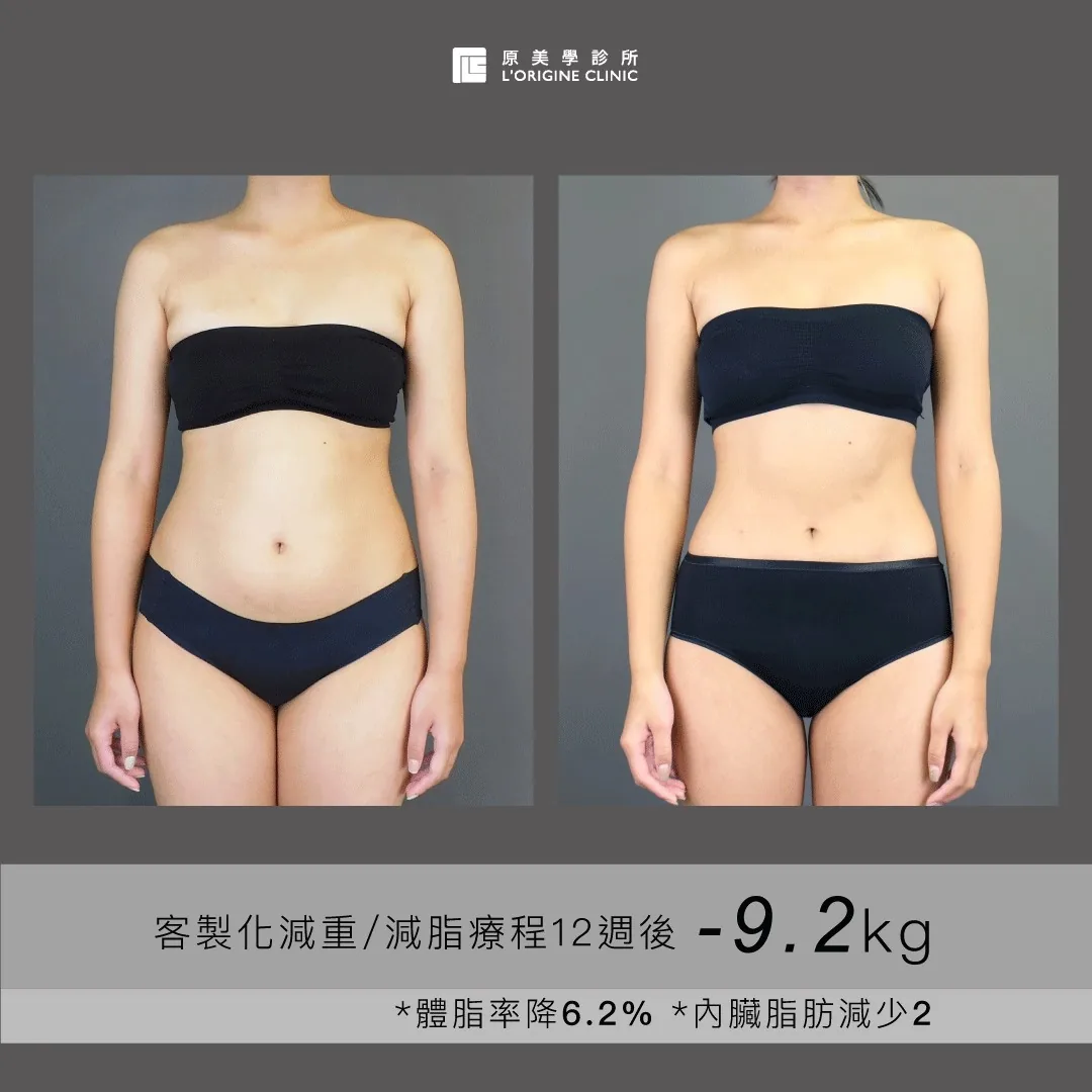 醫師減重門診 療程前後